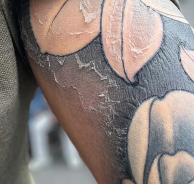 The Science of Tattoo Healing: What Really Happens to Your Skin